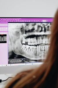 Röntgenaufnahme eines Gebisses auf einem Computerbildschirm. Solche Röntgenbilder sind ein entscheidendes Werkzeug für die Diagnose von CMD und Kiefergelenksproblemen. Sie helfen Kieferorthopäden dabei, Fehlstellungen zu erkennen und individuelle Behandlungspläne zu erstellen, um die Beschwerden der Patienten zu reduzieren.